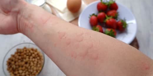 Food Allergens - Featured Image