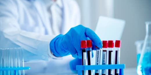 Quality Control in Blood Bank - Featured Image