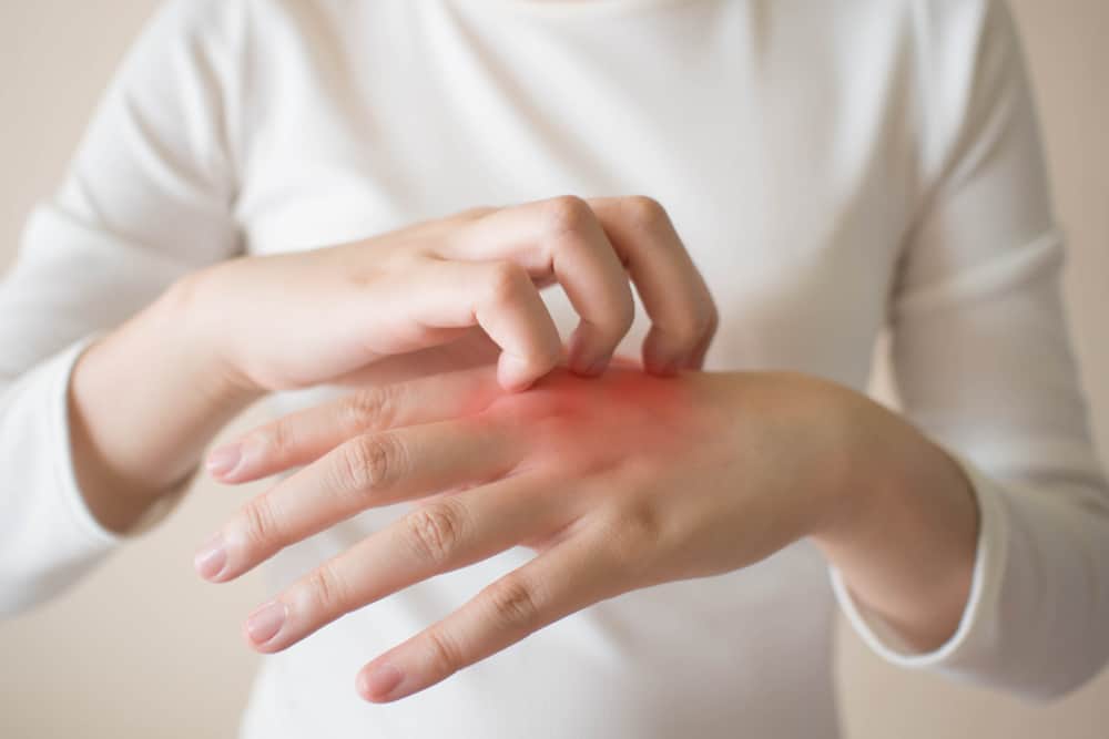 A woman with occupational dermatitis, scratching her hands.